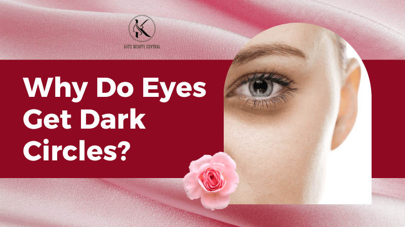Dark Circles