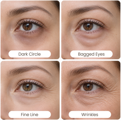 Katz Beauty Revitalizing Eye Gel – Hydrate, Brighten & Reduce Puffiness