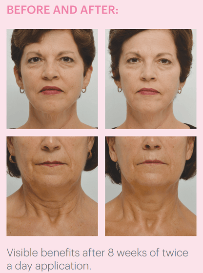 Young Eyes Contour Gel - Smooth & Hydrate Eye Area | KatzBeautyCentral.com 